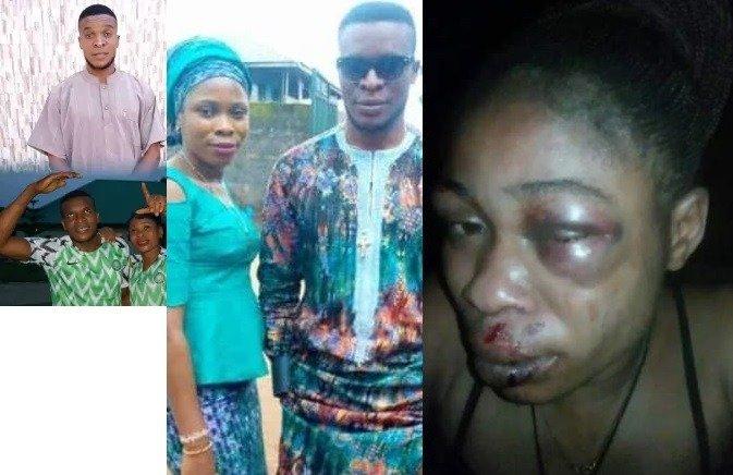 Man Inflicted Injuries on his wife for refusing to abort their 3-month-old pregnancy